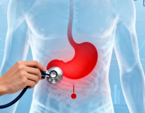 Gastrointestinal Discomfort Gastrointestinal Discomfort
